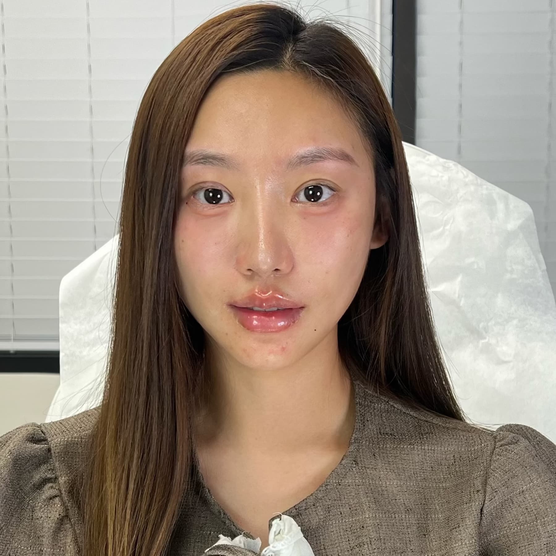 After