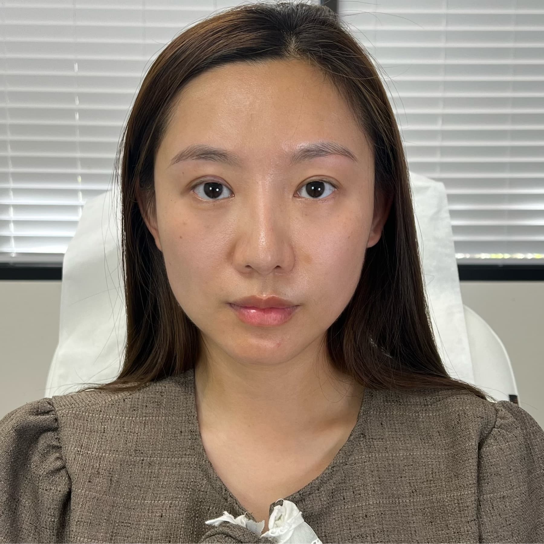 Before